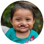 Click here for more information about Reconstructive Cleft Surgery Match